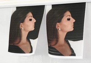 Morphing en consultation pour une rhinoplastie